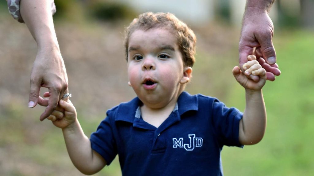 Costello syndrome