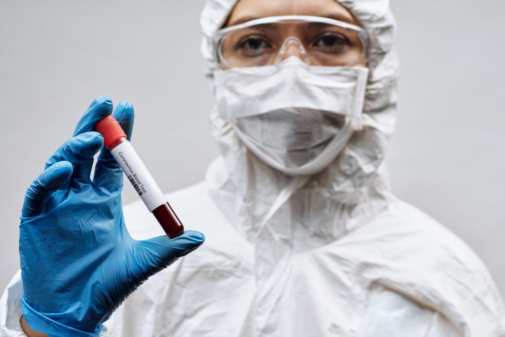 Blood Urea Nitrogen (BUN) Test